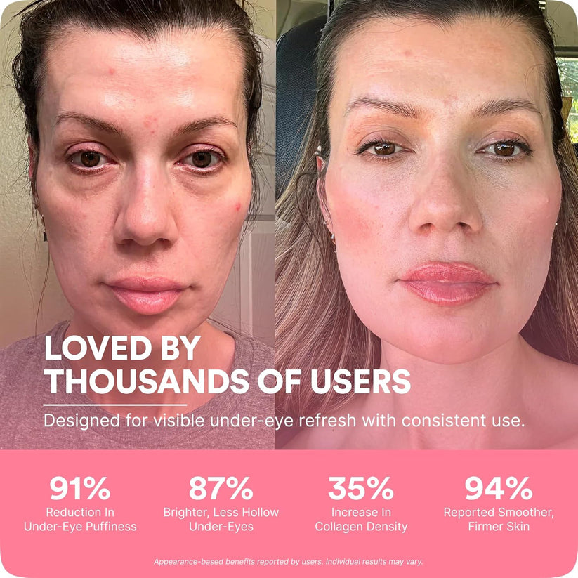 How RedGlow Eye Pro works — Red Light Therapy and Microcurrent technology explained